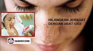 Cara Mudah Hilangkan Jeragat Dengan Gunakan Ubat Gigi