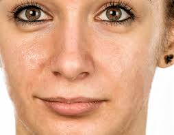 Forehead Pimples Projects :: Photos, videos, logos, illustrations and  branding :: Behance