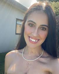 A long waited scar update ❣️ Left : 5 months post Middle : 11 months post  Right : Today