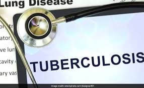 Kannada keyboard online is the best and most comfortable virtual keyboard to type in kannada alphabets, letters, and words. Tuberculosis Treatment 8 Foods That Can Help You Recover Faster