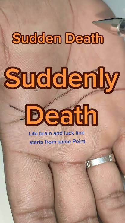 Understanding Sudden Death Line in Palmistry