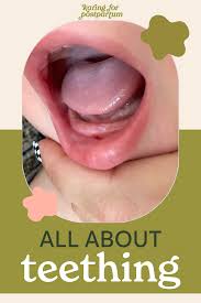 Image result for Teething