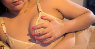 Finance cosmetic surgery and other beauty procedures and get the look you want now with the carecredit credit card. Breast Reduction Before And After Experience Essay
