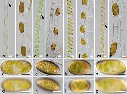 Maybe you would like to learn more about one of these? Identification Of 13 Spirogyra Species Zygnemataceae By Traits Of Sexual Reproduction Induced Under Laboratory Culture Conditions Scientific Reports