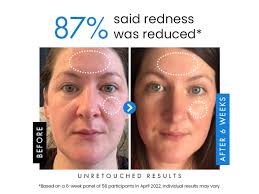 Amazon.com: Eclat Skincare Hyaluronic Acid Serum for Face