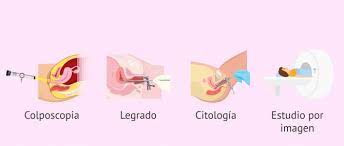 Señales iniciales de sarcoma uterino, información sobre primeros signos de carcinoma cervicouterino (cervical) y neoplasia de endometrio. Cancer De Cuello De Utero Sintomas Diagnostico Y Tratamiento
