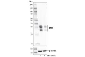 Midwest furfest (abbreviated mff) is the world's largest furry convention, which takes place in rosemont, illinois each december. Mff E5w4m Xp Rabbit Mab Cell Signaling Technology