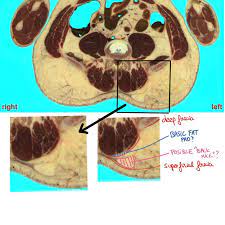 63 Questions With Answers In Low Back Pain Science Topic