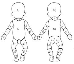 rule of nines chart child paediatric emergency medicine