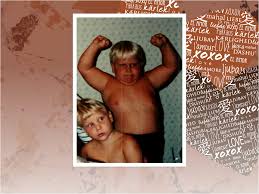 Dale And Mose Mock: Our Son, Caleb, 25 Year Old With Burkitt's Lymphoma