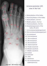 Image result for Foot XRay