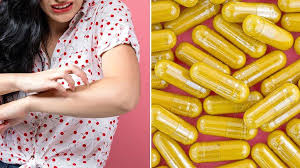 Can Turmeric Help Eczema Or Atopic Dermatitis Everyday Health