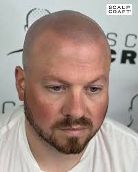 Jack Sharp @sharpsmp one of the longest-serving SMP artists in the UK  🇬🇧showing us how it's done with DermaShield by SMT 🙌 It's incredible to  see someone with Jack's experience trusting and