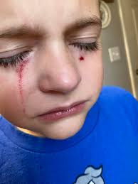 BYC (BackYardChickens)