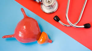 Prostatakrebs Symptome Behandlung Lebenserwartung Onmeda De
