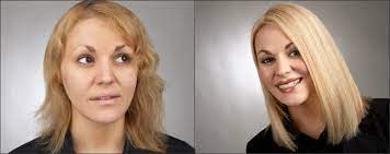 But what if you have thin hair? Are Extensions Safe For Your Hair Salon Nadwa Hair Loss Center