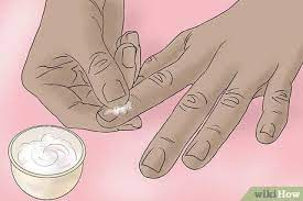 3 Ways To Get Rid Of White Spots On Your Nails - Wikihow | White Spots On  Toenails, White Dots On Nails, White Spots On Nails