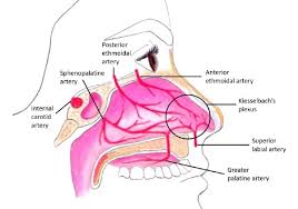 Image result for Epistaxis