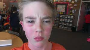 Sometimes we store a blade of grass in the lips