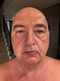 So I'm really struggling down to 2 fags a days, sober since 19th Oct, BUT  I've started drinking Red Bull instead 😒