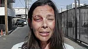 Candice Mitchell Memorial Page