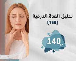 صورة تحليل الغدة الدرقية