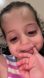 she literally always falling down😩 #sistervibe #fypシ゚viral #chubbycheeks  #bigface #littlesister #babygirl #dora #facehurts