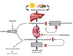 Vitamin D And Kidney Stones Urology