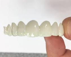 A new digitally designed smile makeover that uses the latest innovation of design and technology to completely transform your smile. Snap On Smile Easy Pain Free True Smile Veneers