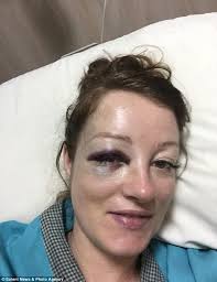 Couple survive SECOND honeymoon from Hell when Bali ferry EXPLODED