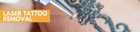 Our job is to help people in new york city reflect on the outside, who they are on the inside. Laser Tattoo Removal Remove Or Fade Unwanted Tattoos Birthmarks Dermaenvy Skincare Medical Aesthetics Laser Hair Removal And Skin Care Clinic