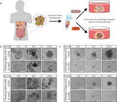 Colorectal cancer starts in the colon or the rectum, usually as a growth on the inner lining of the organ. Fgf Signalling In The Self Renewal Of Colon Cancer Organoids Scientific Reports