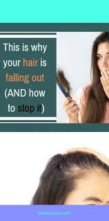 Salman Khan Hair Transplant You Can Get Additional Details At The Image Link Hair Loss Solutions Hair Falling Out Hair Transplant
