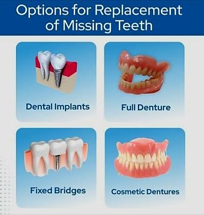 Replacement of missing teeth product image