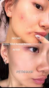 How to Use K Secret Seoul 1988 Serum and Cream | TikTok