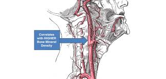 The neck is supplied by arteries other than the carotids. Thick Carotid Arteries Higher Bone Mineral Density Orthopedics This Week