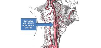 /kəˈrɒtɪd/) are arteries that supply the head and neck with oxygenated blood; Thick Carotid Arteries Higher Bone Mineral Density Orthopedics This Week