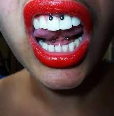 Pin On Smiley Piercings