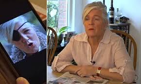 Woman Lost Her Eye When She Took A Shower While Wearing Contacts Take A Shower Losing Her Take That