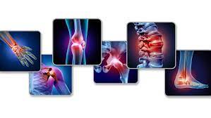 Rheuma Arthrose Arthritis Gemeinsamkeiten Und Unterschiede Gesunder Korper