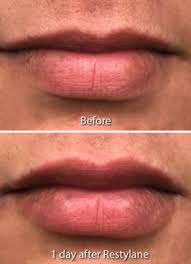 Maybe you would like to learn more about one of these? Transgender Dermatology At Cosmetic Laser Dermatology In Sd