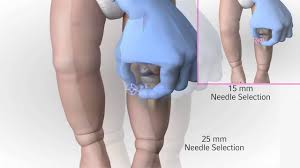 Image result for Intraosseous Access