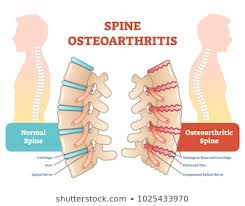 Cervical Spine Photos 11 133 Cervical Stock Image Results