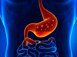 Image result for gas problem