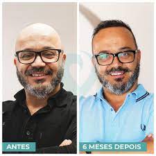 Durante as últimas três décadas, fui repórter e apresentador da rede globo; Fernando Rocha Ja Tem Cabelo E Esta Mais Magro Veja O Antes E Depois Do Humorista