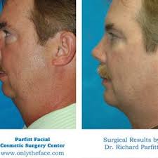 PARFITT FACIAL COSMETIC SURGERY CENTER