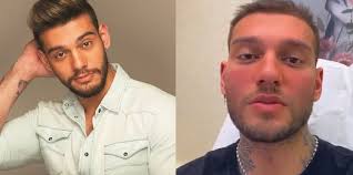 Sep 25, 2020 · wesley safadão e thyane dantas se renderam à harmonização facial, procedimento queridinho das famosas. Harmonizacao Facial Qual E O Limite Na Busca Para Atingir Um Padrao Jd1 Noticias