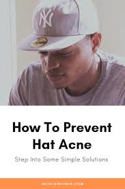 How To Prevent Hat Acne Step Into Some Simple Solutions Forhead Acne Acne Prevention