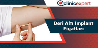 Deri Alti Implant Fiyatlari 2020 Clinicexpert Uluslararasi Saglik Hizmetleri