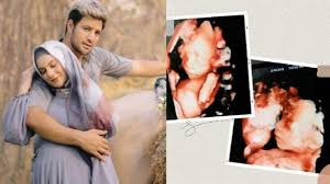 Mirror syndrome refers to an obsession with our reflection and a tendency to distort it in our minds until we see defects or magnify the ones we believe we have. Ini Pengobatan Mirror Syndrome Kondisi Penyebab Meninggalnya Bayi Kembar Irish Bella Ammar Zoni Tribun Timur